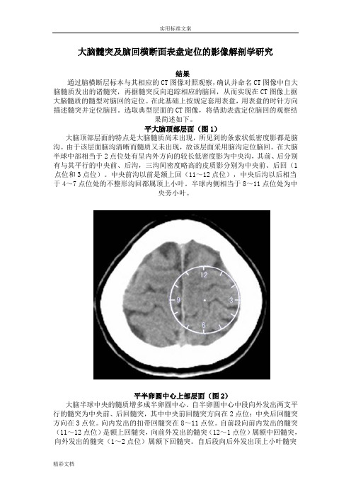 脑池断层影像解剖