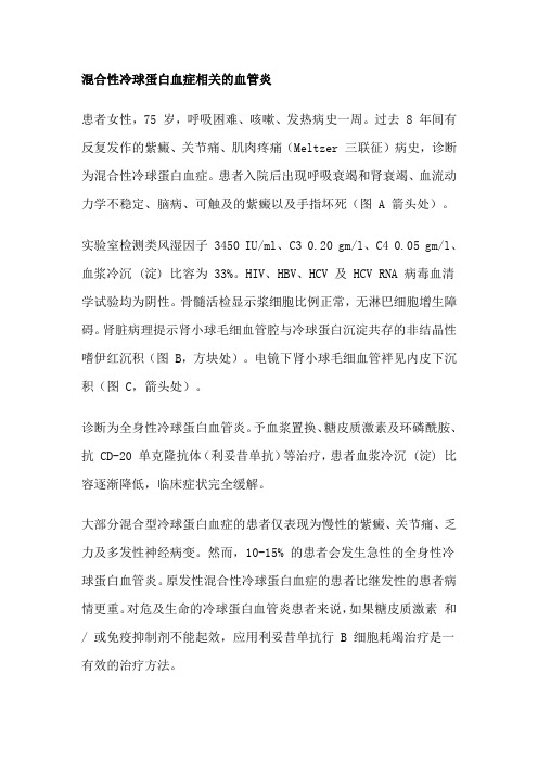 混合性冷球蛋白血症相关的血管炎