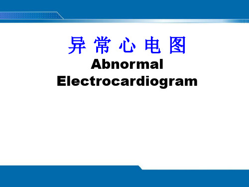 健康评估《异常心电图》课件