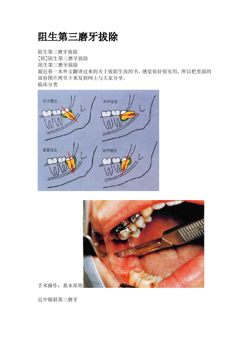 一起学之阻生第三磨牙拔除