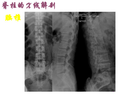 腰椎影像解剖学课件