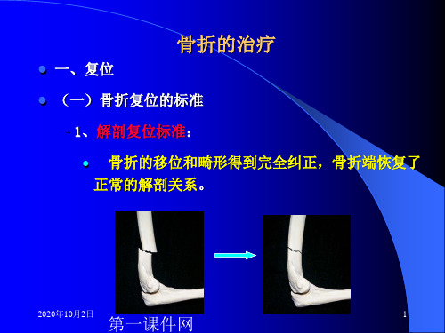 中医伤科学-骨折的治疗PPT课件