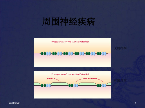 《格林巴利综合征》PPT课件_OK