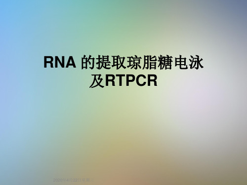 RNA 的提取琼脂糖电泳及RTPCR