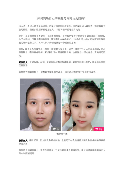 如何判断自己的颧骨是真高还是假高？