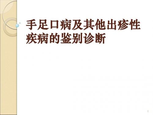 手足口病及其他出疹性疾病的鉴别诊断PPT课件