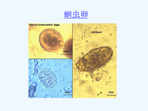 寄生虫学虫卵经典总结及图片