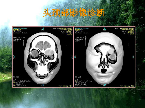 眶部影像医学PPT课件