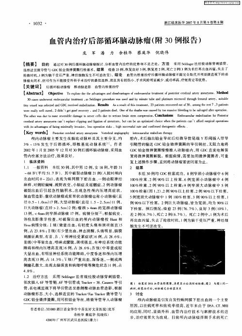 血管内治疗后部循环脑动脉瘤(附30例报告)