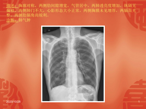 常见40张X片读片及诊断 ppt课件