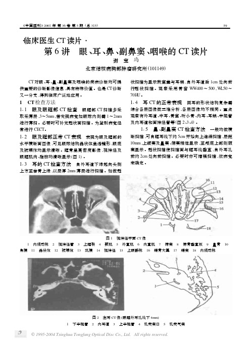 第6讲 眼、耳、鼻、副鼻窦、咽喉的CT