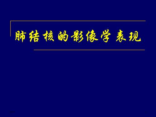 肺结核讲课课件ppt课件