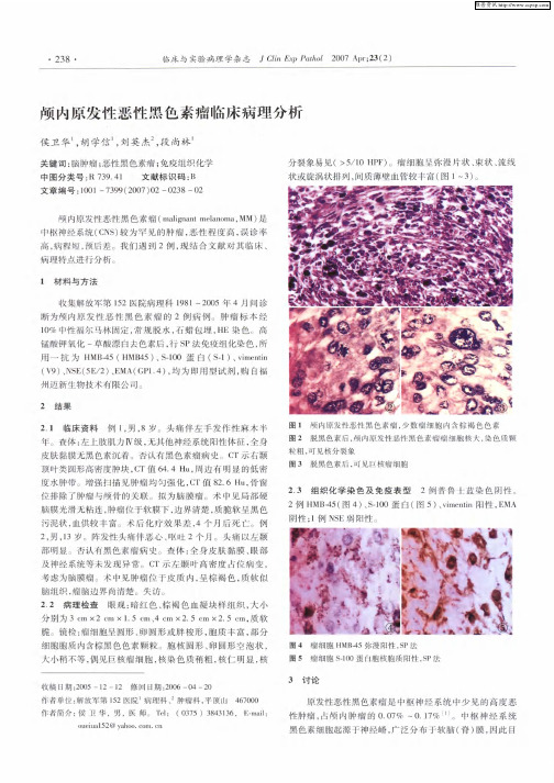 颅内原发性恶性黑色素瘤临床病理分析