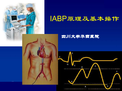 IABP原理及基本操作PPT课件