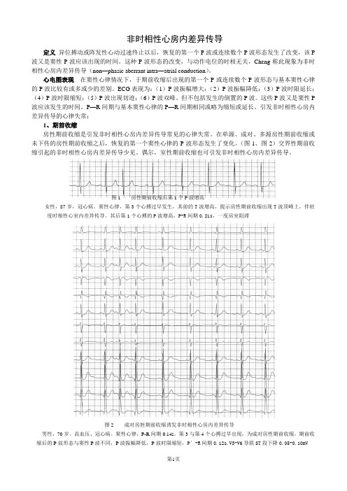 非时相性心房内差异传导