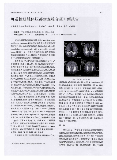 可逆性胼胝体压部病变综合征1例报告