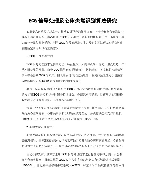 ECG信号处理及心律失常识别算法研究