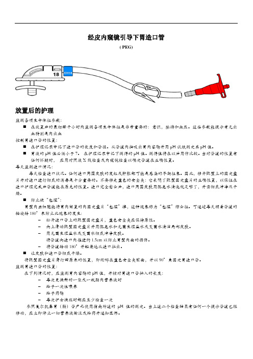 经皮内窥镜引导下胃造口管使用说明书PEG