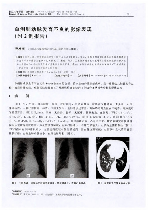 单侧肺动脉发育不良的影像表现(附2例报告)