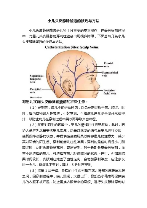 小儿头皮静脉输液的技巧与方法