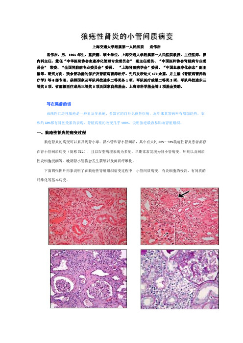 最新狼疮性肾炎的小管间质病变(袁伟杰)