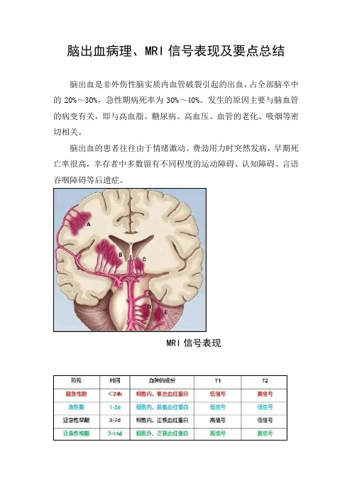 临床脑出血病理、MRI信号表现及要点总结