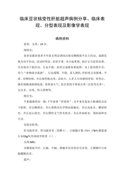 临床豆状核变性肝脏超声病例分享临床表现分型表现及影像学表现