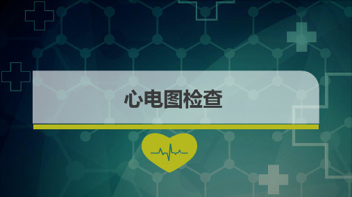 常见心电图诊断要点