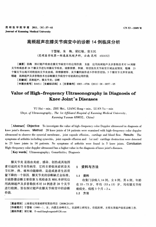 高频超声在膝关节病变中的诊断14例临床分析