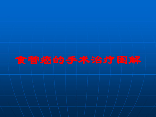 食管癌的手术治疗图解培训课件