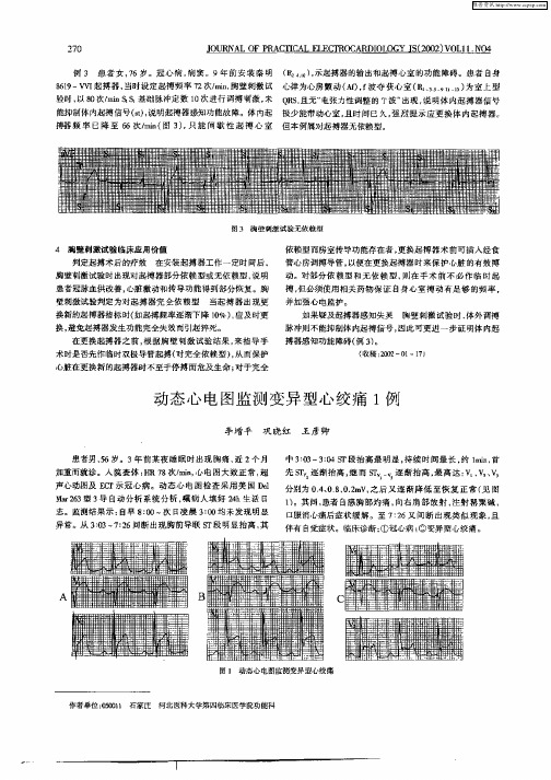 动态心电图监测变异型心绞痛1例