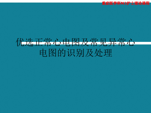 优选正常心电图及常见异常心电图的识别及处理