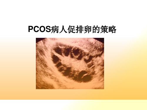 PCOS病人促排卵的策略