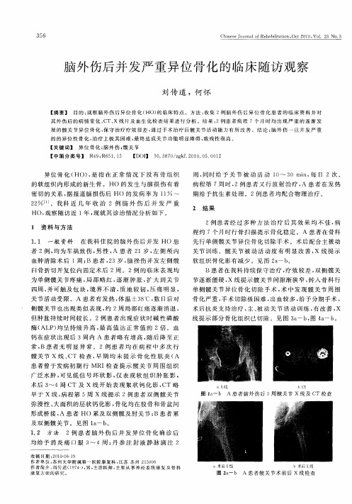 脑外伤后并发严重异位骨化的临床随访观察