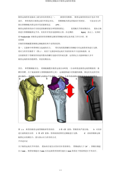 掌侧锁定钢板治疗桡骨远端骨折教案