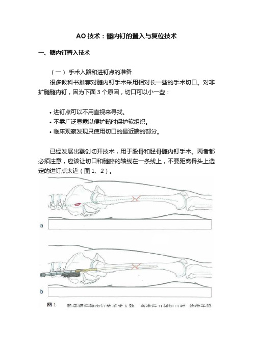 AO技术：髓内钉的置入与复位技术