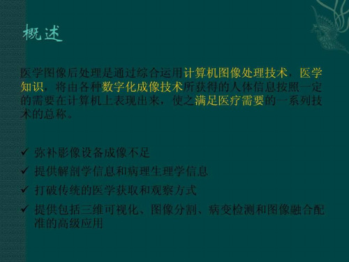 《医学影像后处理》PPT课件