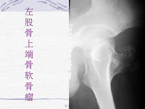 骨肿瘤X线病例图谱(1)