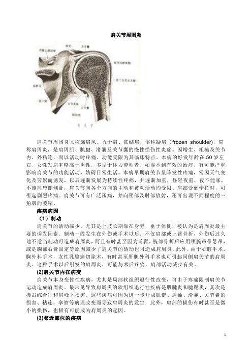 肩关节周围炎