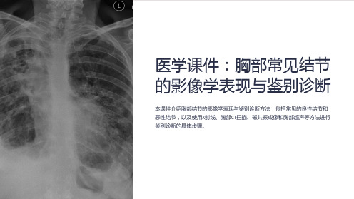 《医学课件：胸部常见结节的影像学表现与鉴别诊断》