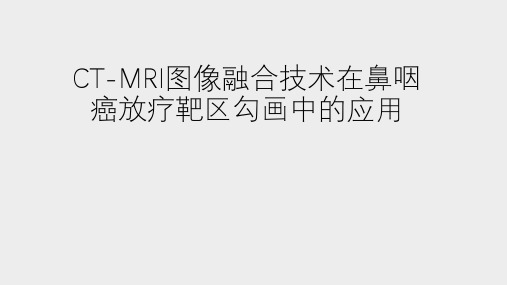 CT-MRI图像融合技术在鼻咽癌放疗靶区勾画中的应用