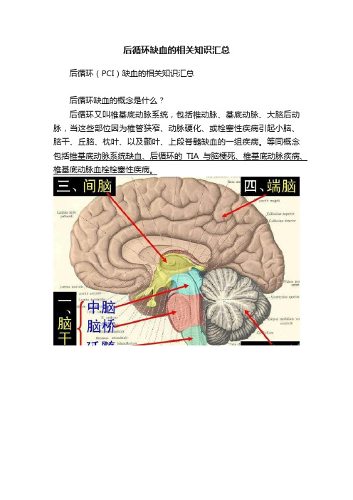 后循环缺血的相关知识汇总