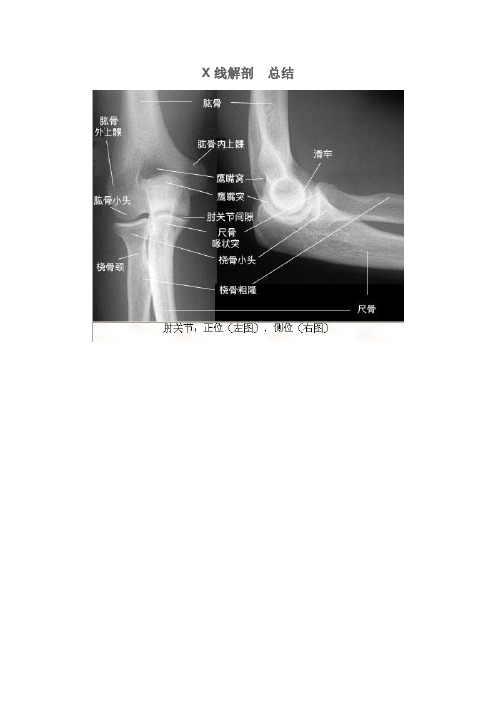 X线  片子   解剖  精讲  总结