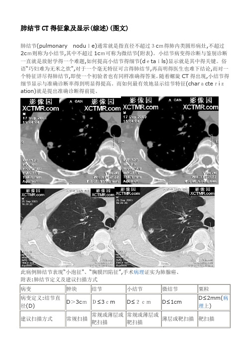 肺结节CT的征象及显示