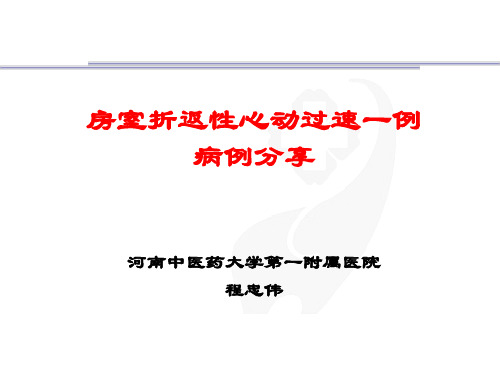 房室折返性心动过速一例病例分享