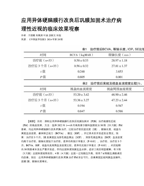 应用异体硬脑膜行改良后巩膜加固术治疗病理性近视的临床效果观察