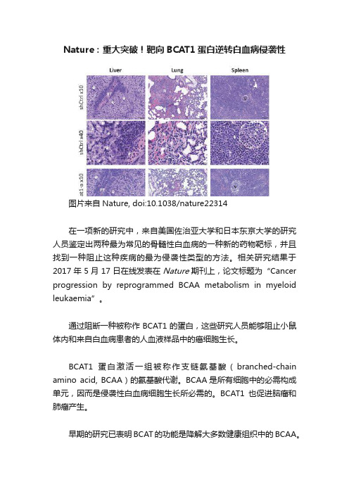 Nature：重大突破！靶向BCAT1蛋白逆转白血病侵袭性