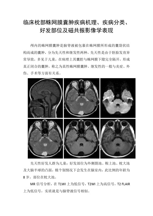 临床枕部蛛网膜囊肿疾病机理、疾病分类、好发部位及磁共振影像学表现