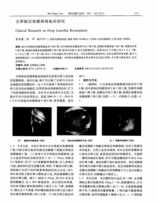 全厚板层角膜移植临床研究