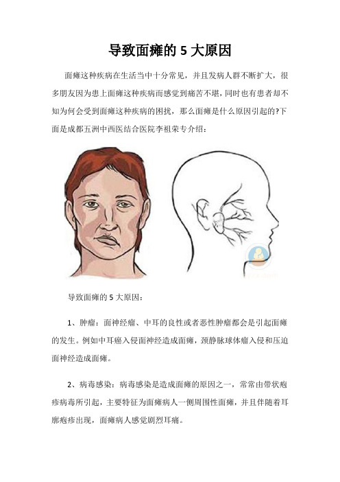 导致面瘫的5大原因